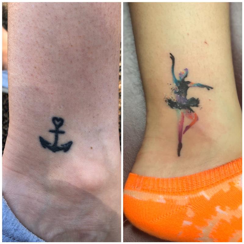 Vol 1 Top 18 Tattoo Cover Ups  Before and After Tattoo Removal