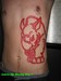 Tattoos - Skin Removal - 52814
