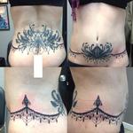 Tattoos - Belly dancer belt covering a circumpherential scar - 126900