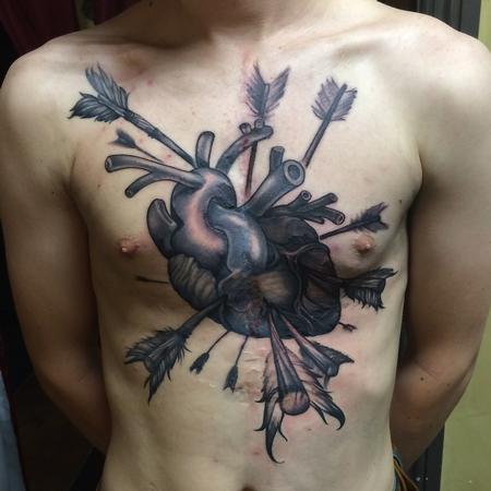 Tattoos - Heart transplant surgery  - 104882