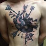 Tattoos - Heart transplant surgery  - 104882