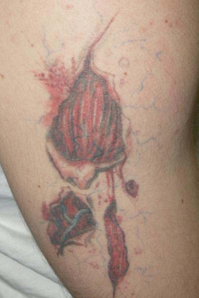 tattoo over varicose veinsTikTok Search