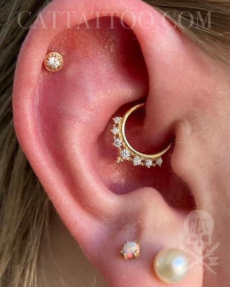 Brittany - Daith and Helix