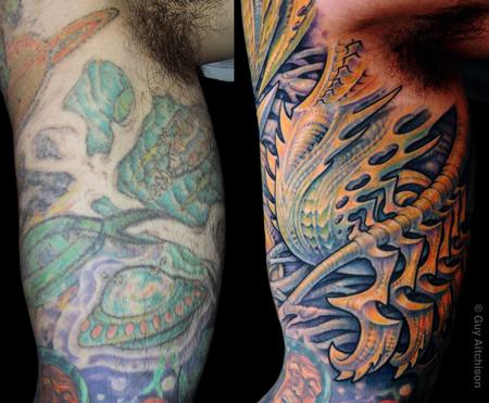 Guy Aitchison - David, inner arm, before and after