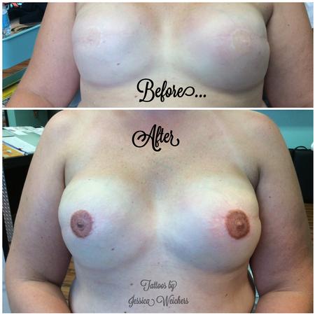 Jessica Weichers - Areola / Nipple Reconstruction Tattoo